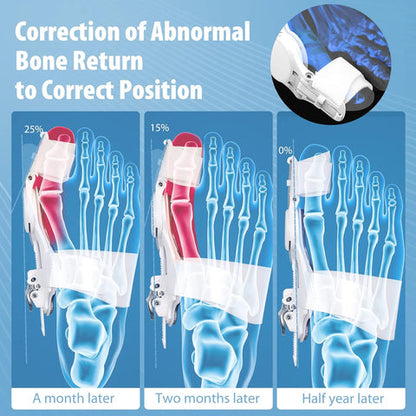 FlexiToe™ Bunion Corrector Brace